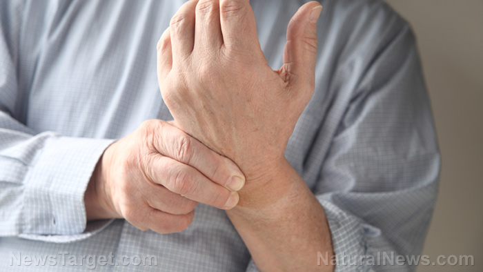 Investigating the efficacy of acupuncture for treating rheumatoid arthritis of the hand